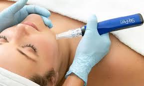 Why Your Skin Will Love SkinPen Microneedling