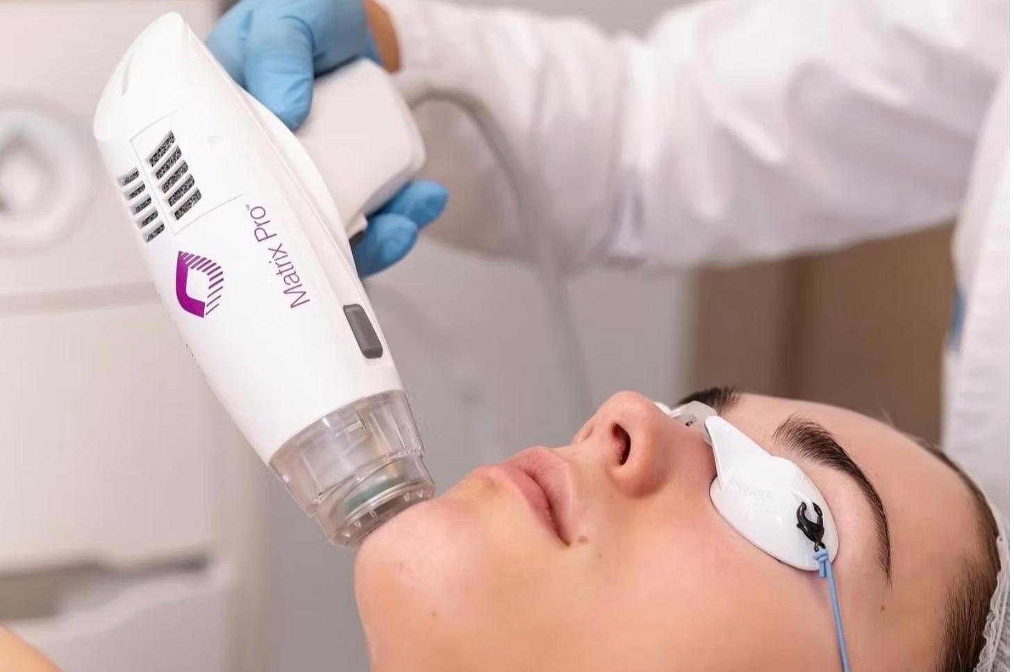 The Benefits of RF Microneedling with MatrixPro at SkinVerse